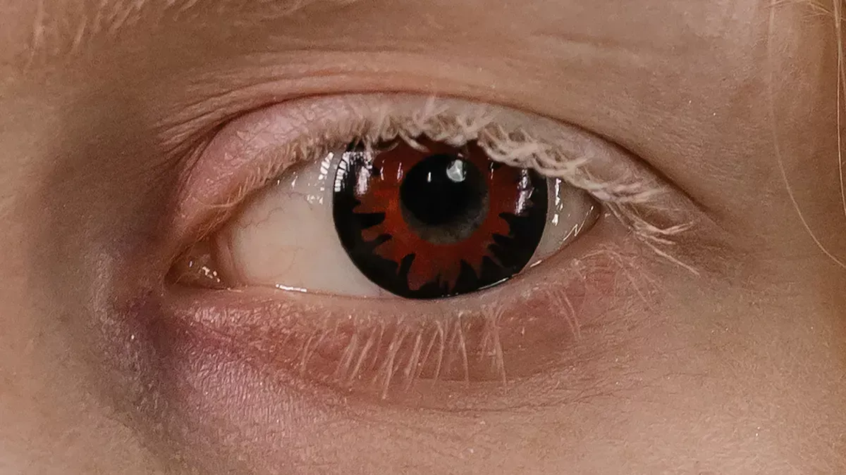 Common Contact Lens Comfort Issues